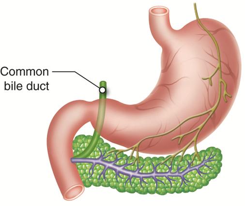 Pancreas3