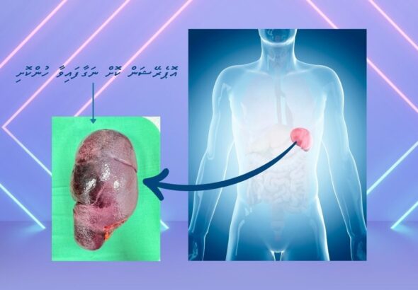 Your paragraph text - 1